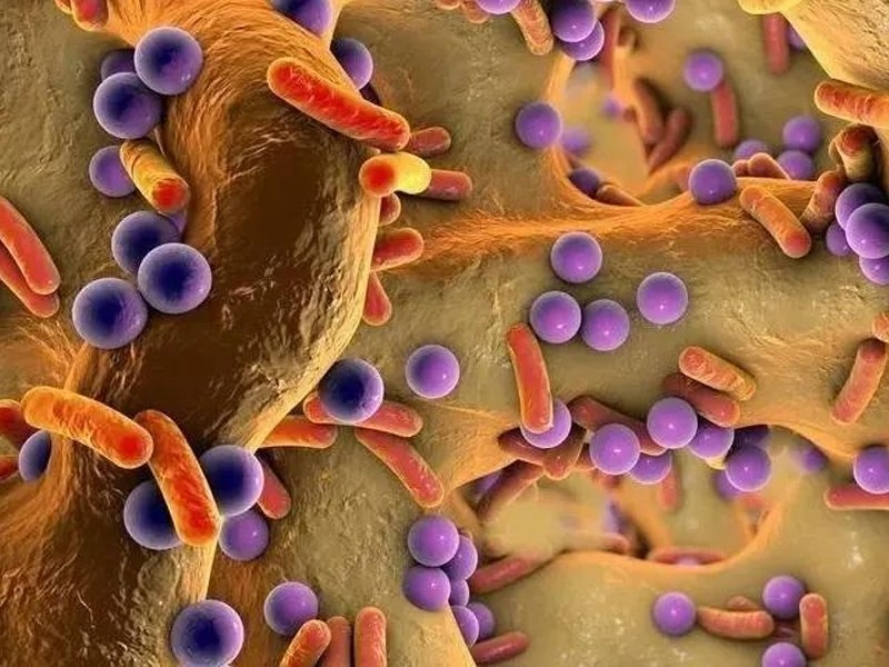 肥胖的關鍵是腸道菌群的變化 | 代謝組學技術揭示分析研究